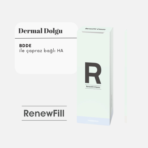 RENEWFILL CLASSIC